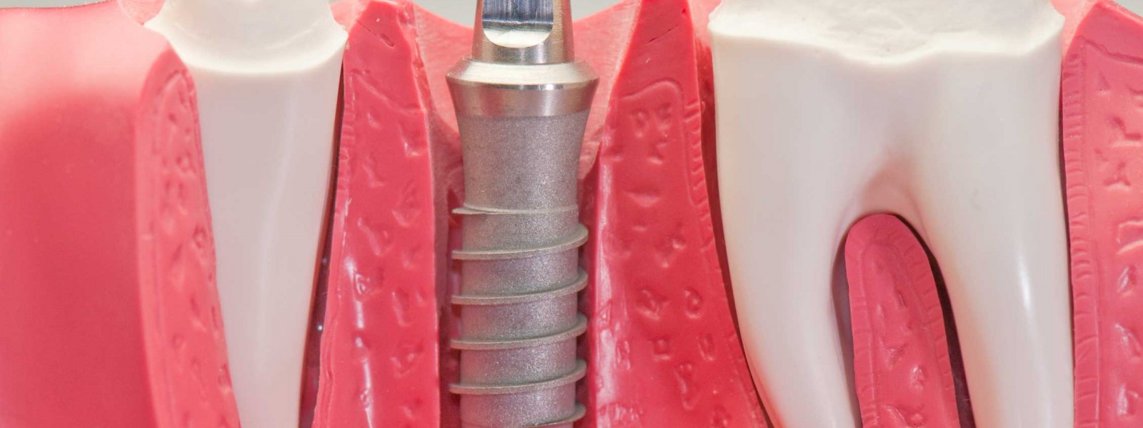 See all the secrets of Oral Hygiene and the best way to achieve the ultimate smile.
Download Now